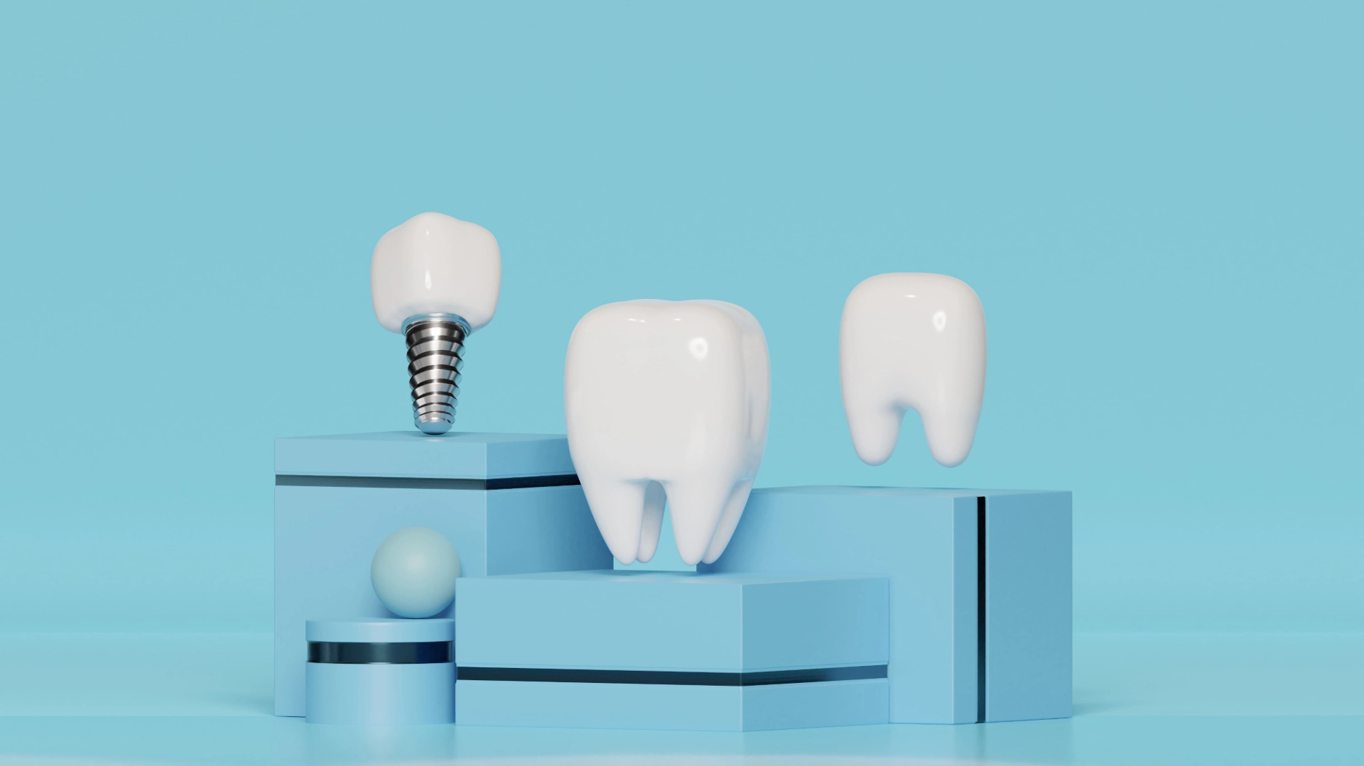Can a Dental Implant Crown Fall Out?