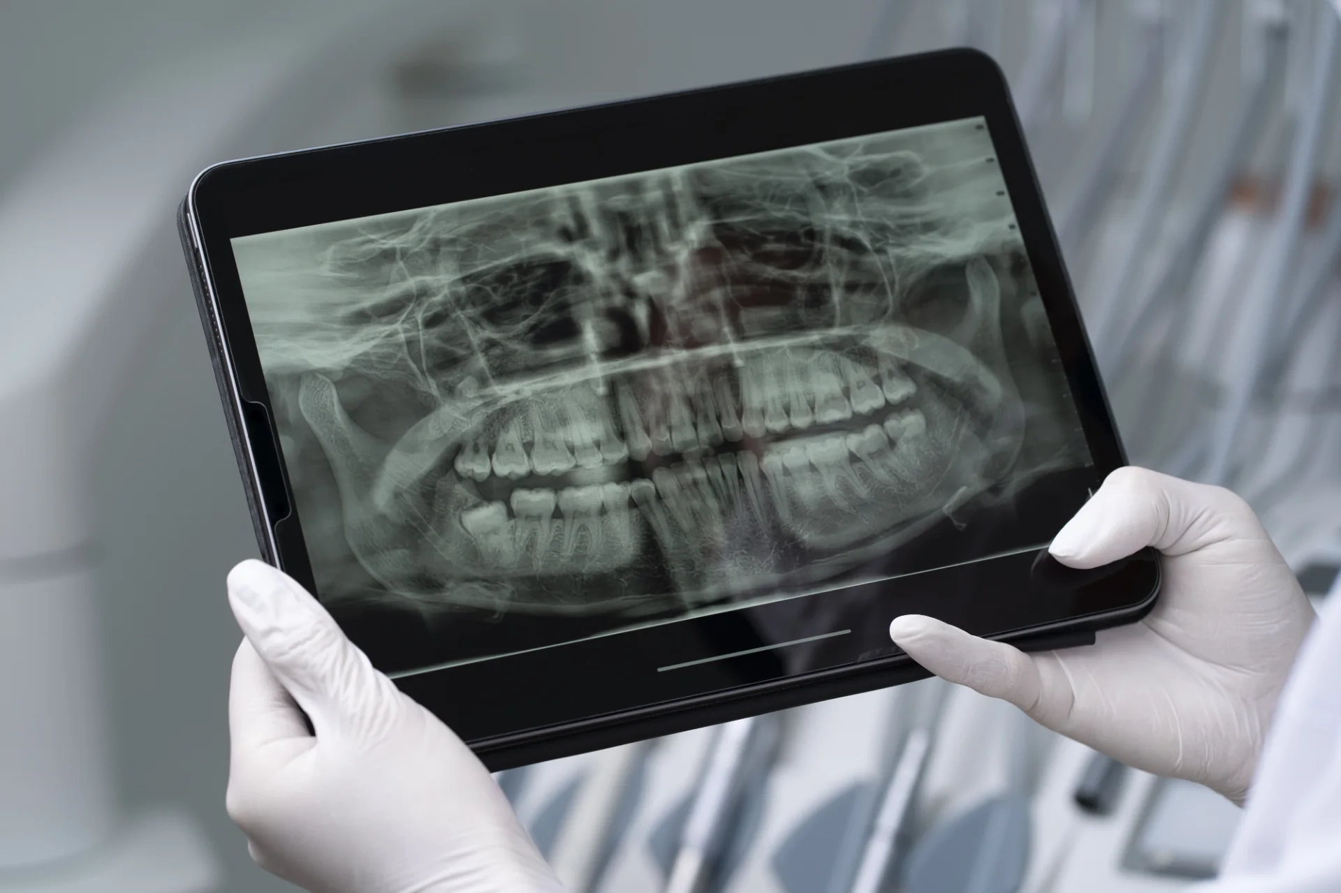 Cephalometric X-Ray: Purpose and Procedure