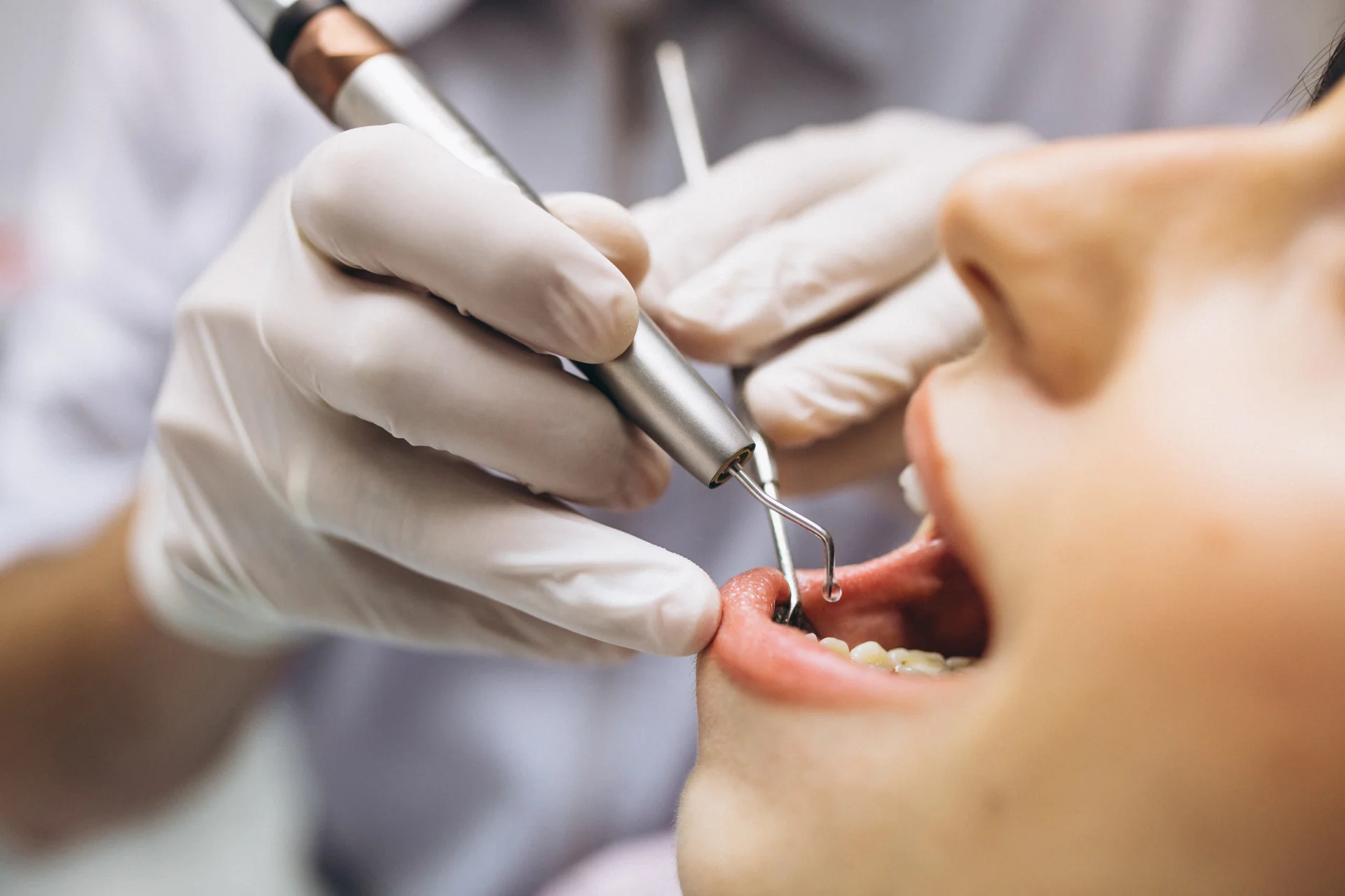 Dental Cleaning Procedure