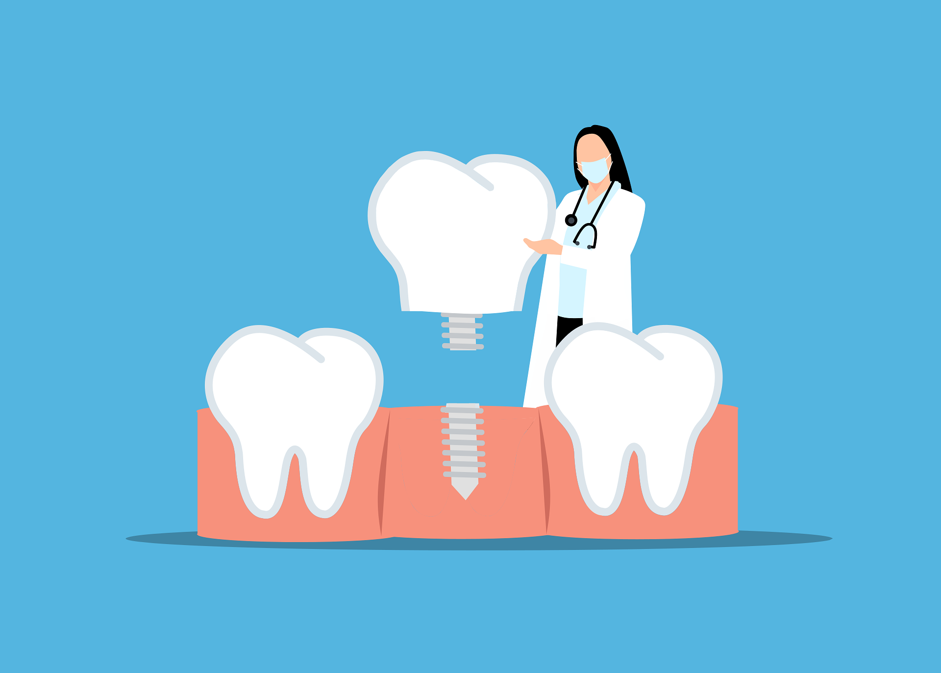 dental implant healing stages