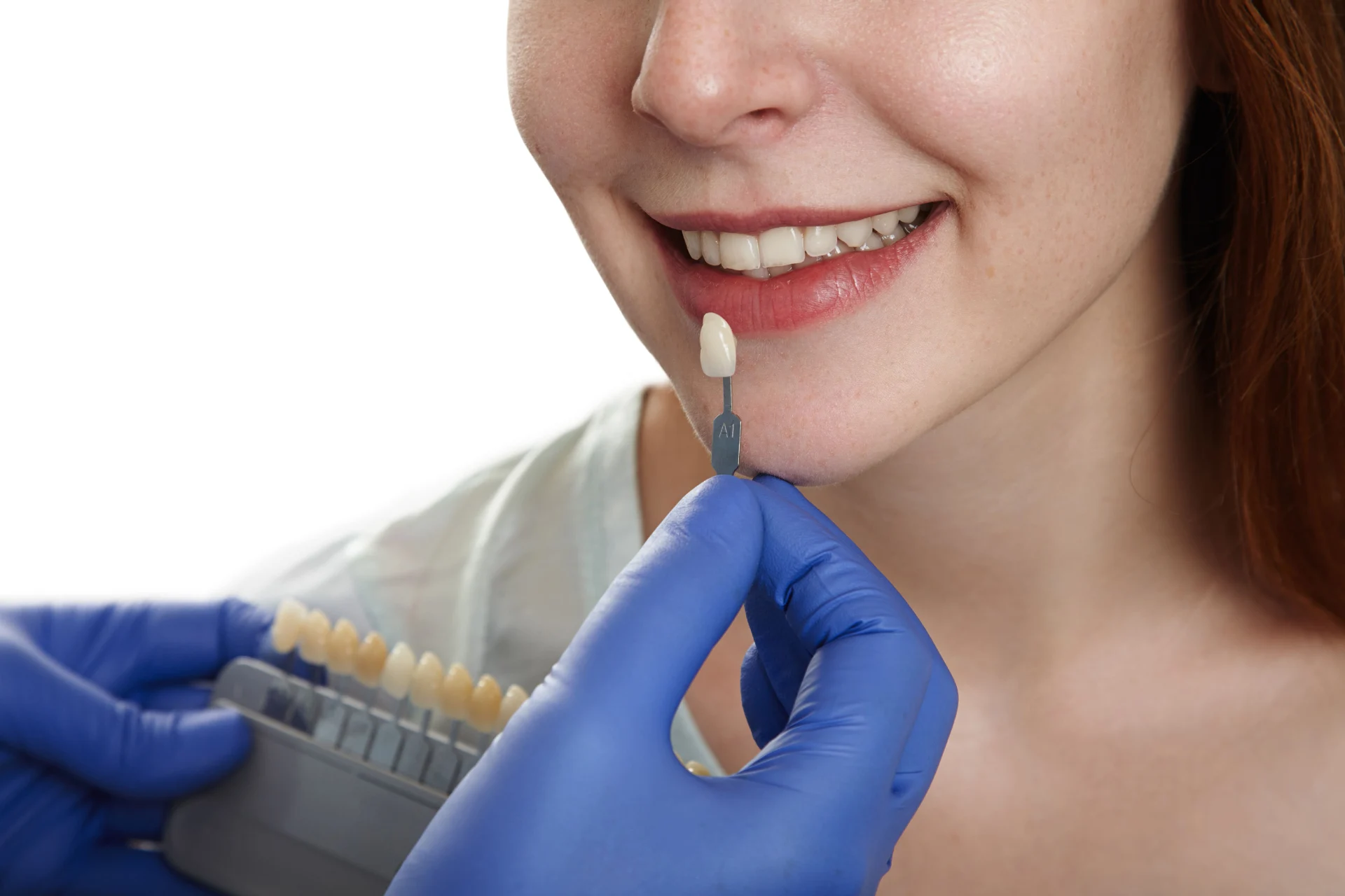 How Long Does a Dental Implant Procedure Take?