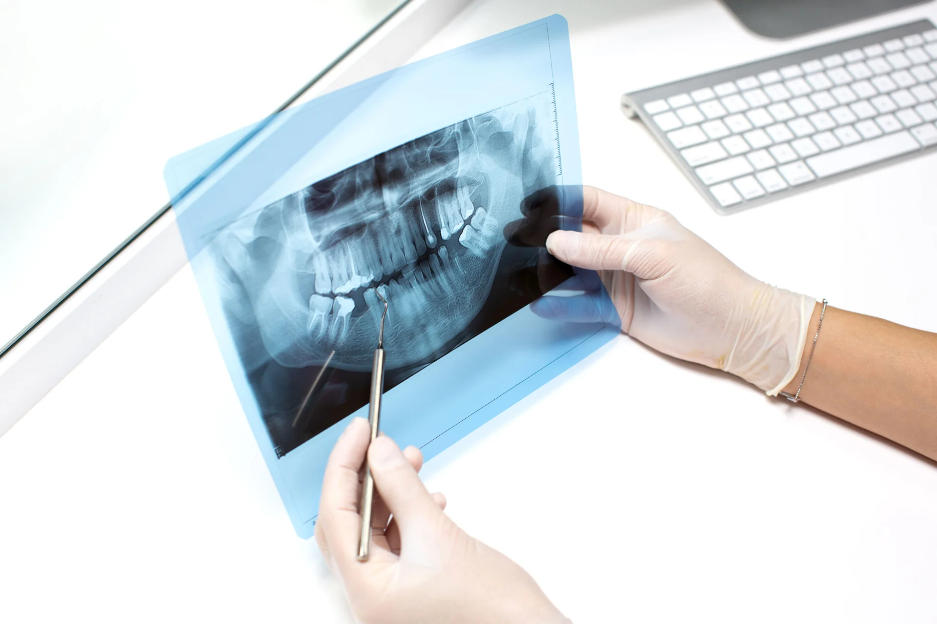 Panoramic X-Ray