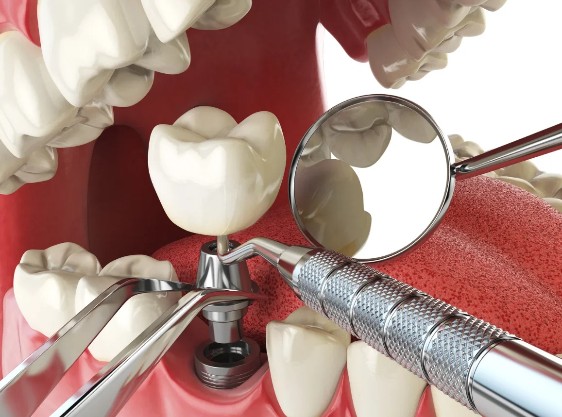 Treatment Bia Dental