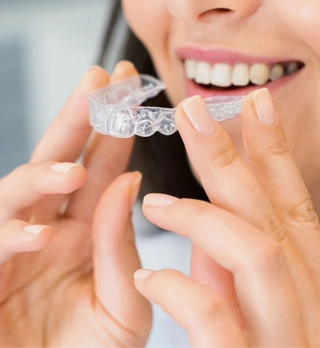 Aligners Bia Dental