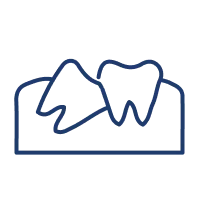 <p>Individu dengan impaksi gigi bungsu yang menyebabkan nyeri, bengkak, atau infeksi.&nbsp;</p>