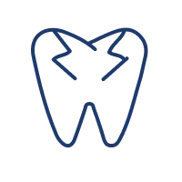 <p>&nbsp;Pasien dengan gigi retak atau aus akibat kebiasaan menggertakkan gigi (bruxism) atau trauma</p>