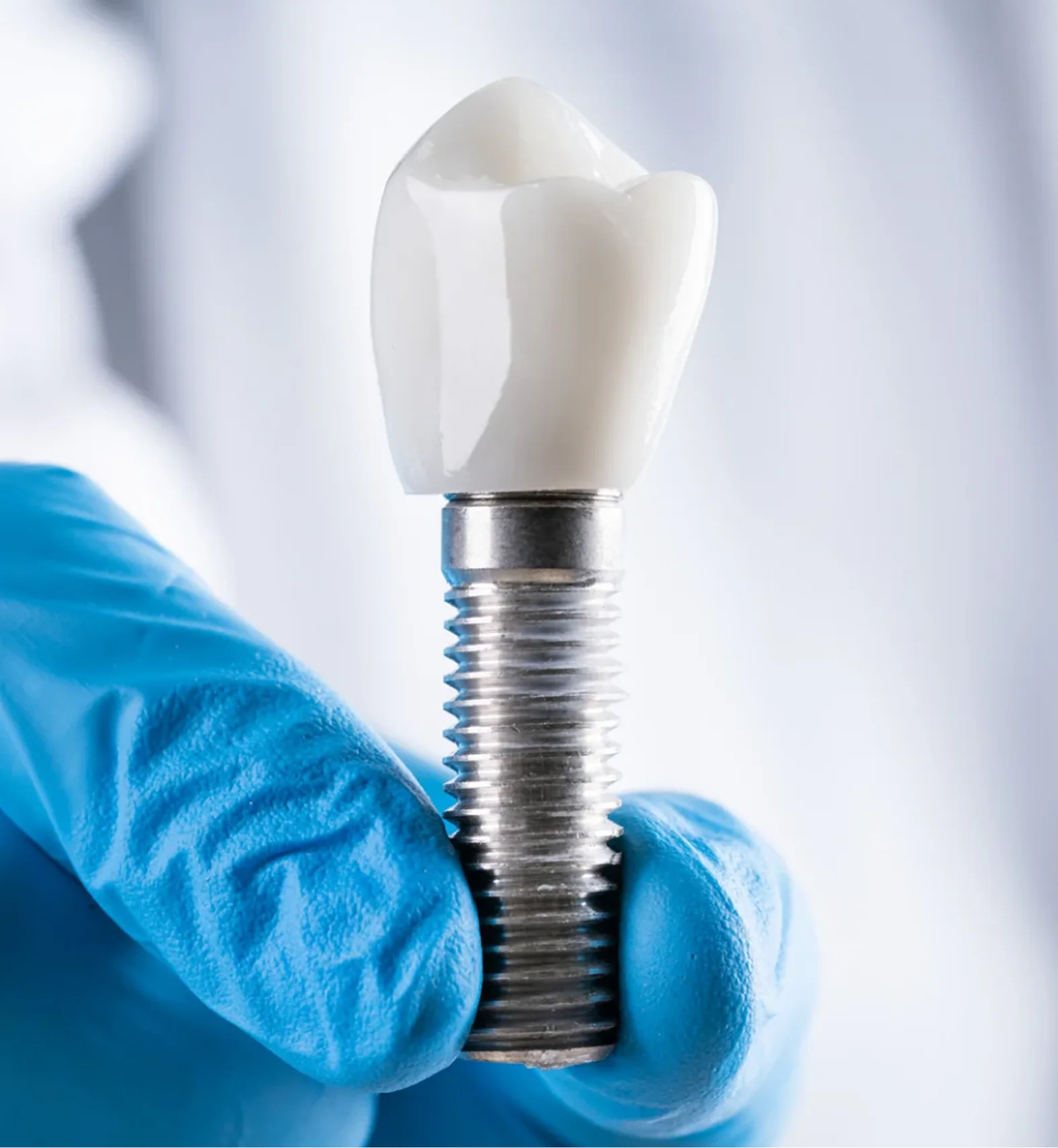 Single Dental Implant Bia Dental
