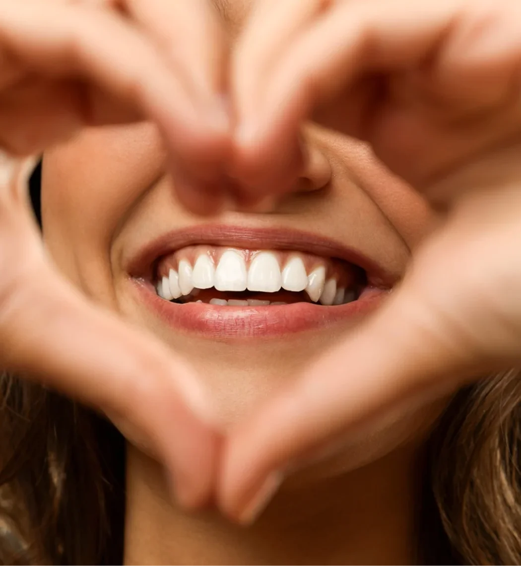 Smile Makeover Bia Dental